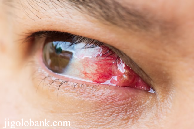 Gejala Gangguan Penglihatan dan Cara Mencegahnya